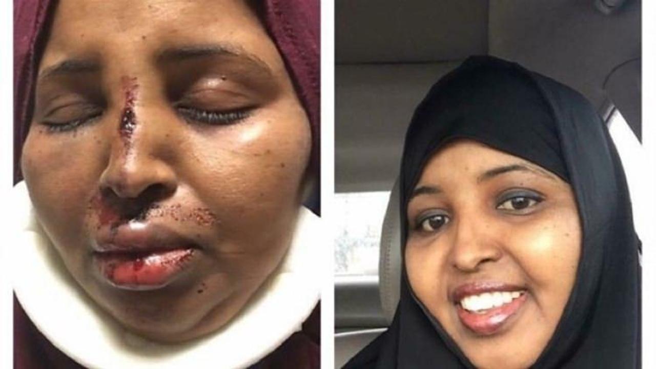 Müslüman kadına alçak saldırı