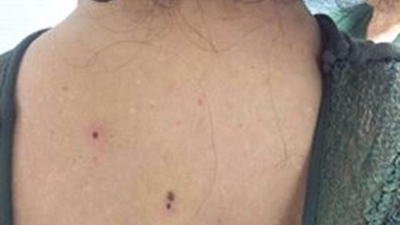 Kına gecesi dehşeti: 4 yaralı