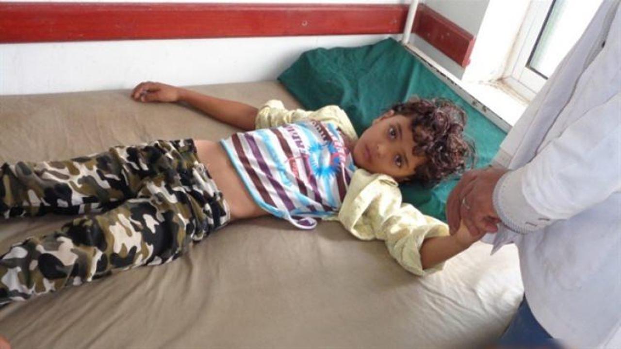 Yemen'de kolera salgını tüm ülkeye yayıldı