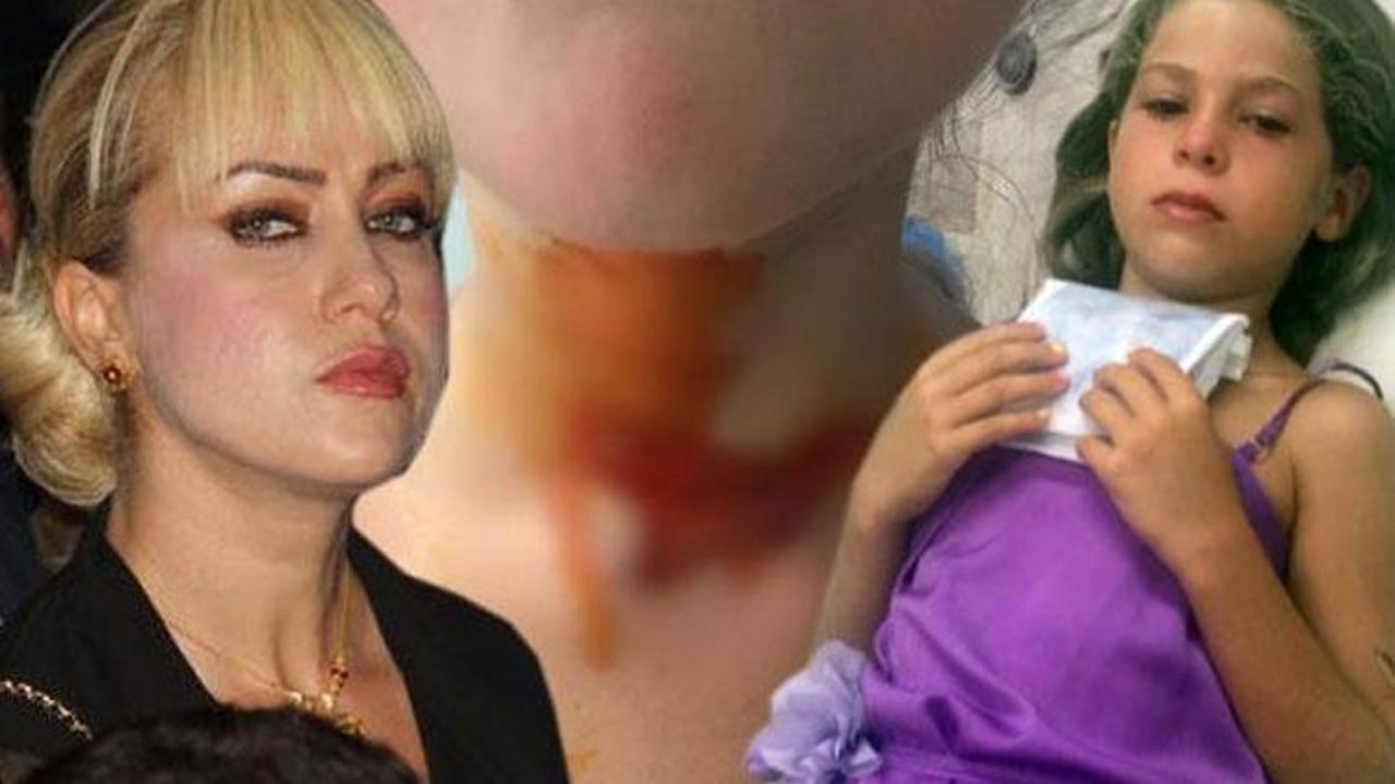 Ünlü oyuncu Yeliz Yeşilmen'in kızını kızgın yağ ile yaktılar