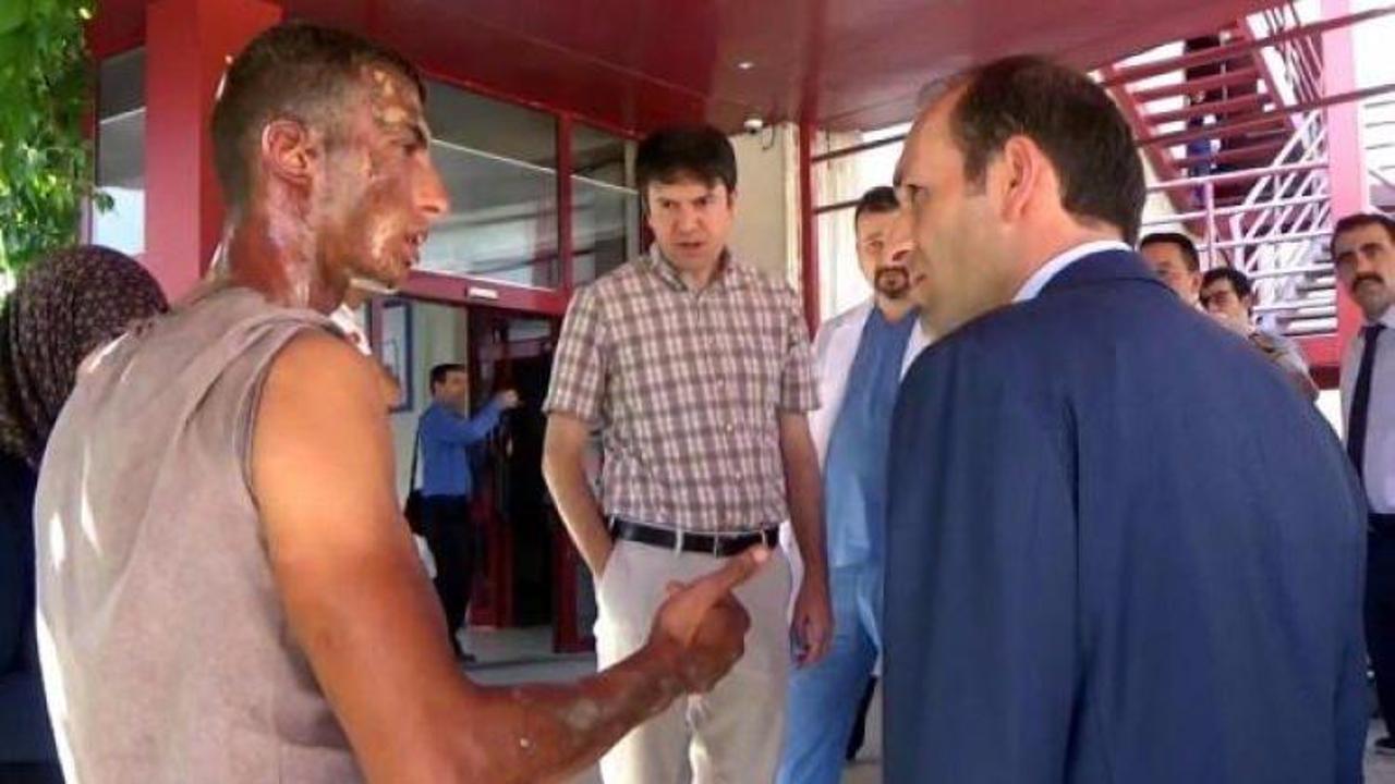 &Ccedil;akmağı yakınca LPG'li otomobilde patlama oldu!