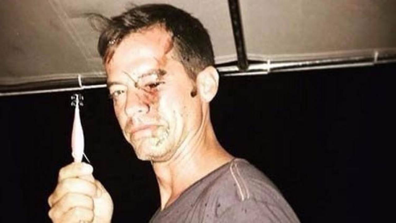 Alp Kırşan sevenlerini korkuttu