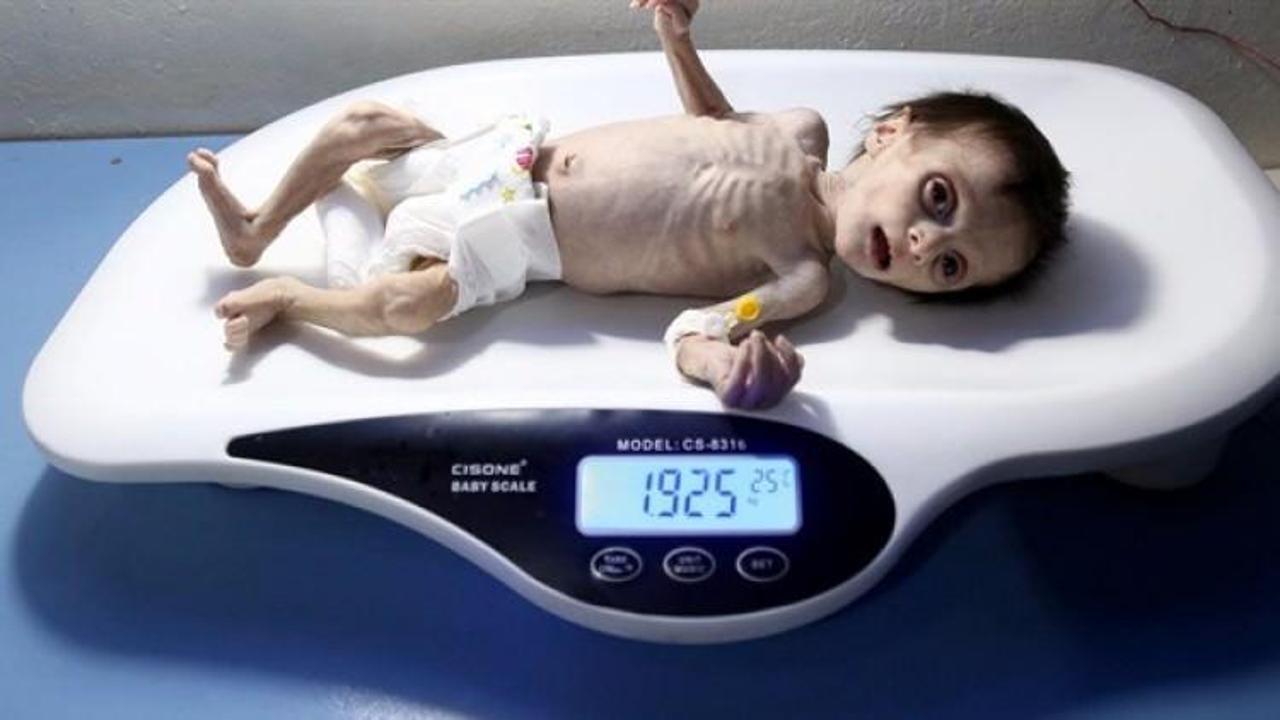 Minik Seher sadece 34 gün dayanabildi