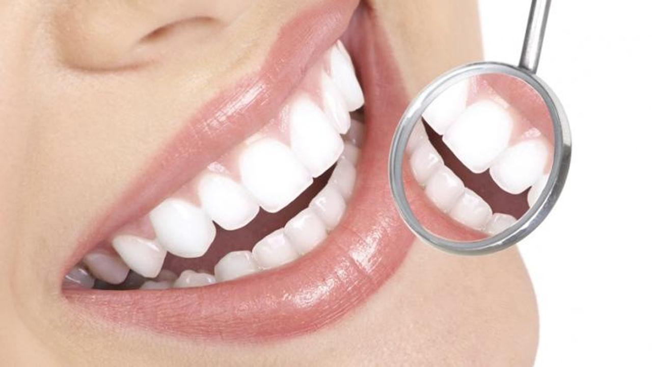 Diş sağlığına iyi gelen besinler 