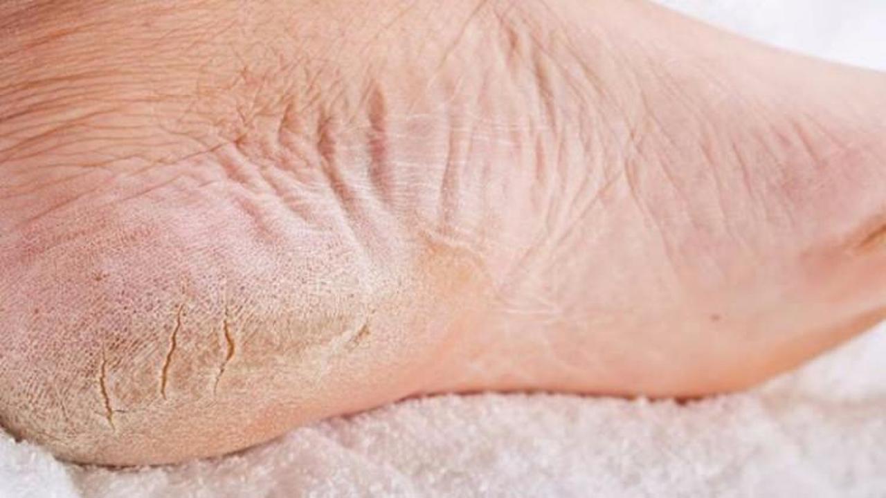 Topuk bakımı nasıl yapılır?