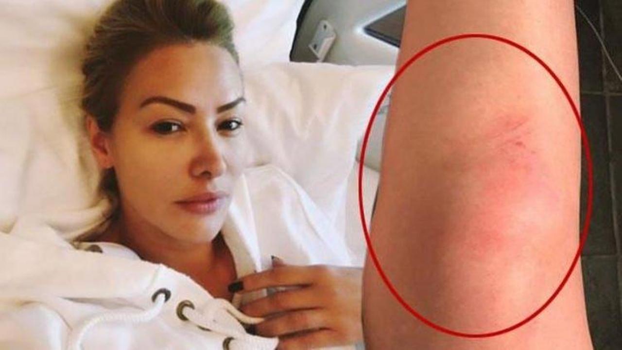 Ünlü şarkıcı klip çekiminde kaza geçirdi!