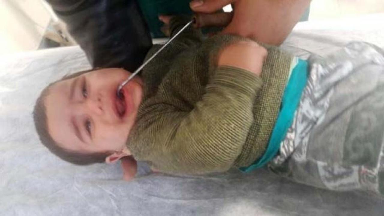 9 aylık Muhammed'in ağzına kova demiri saplandı
