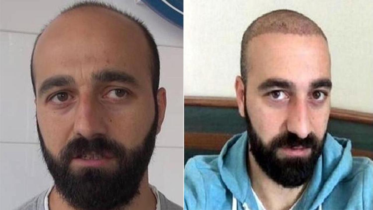 Sa&ccedil; ektiren futbolcu takımdan g&ouml;nderildi!