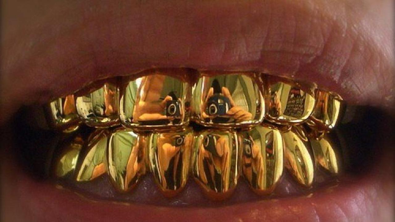 Rüyada altın diş görmek ne anlama gelir? Rüyada altın diş görmenin anlamı