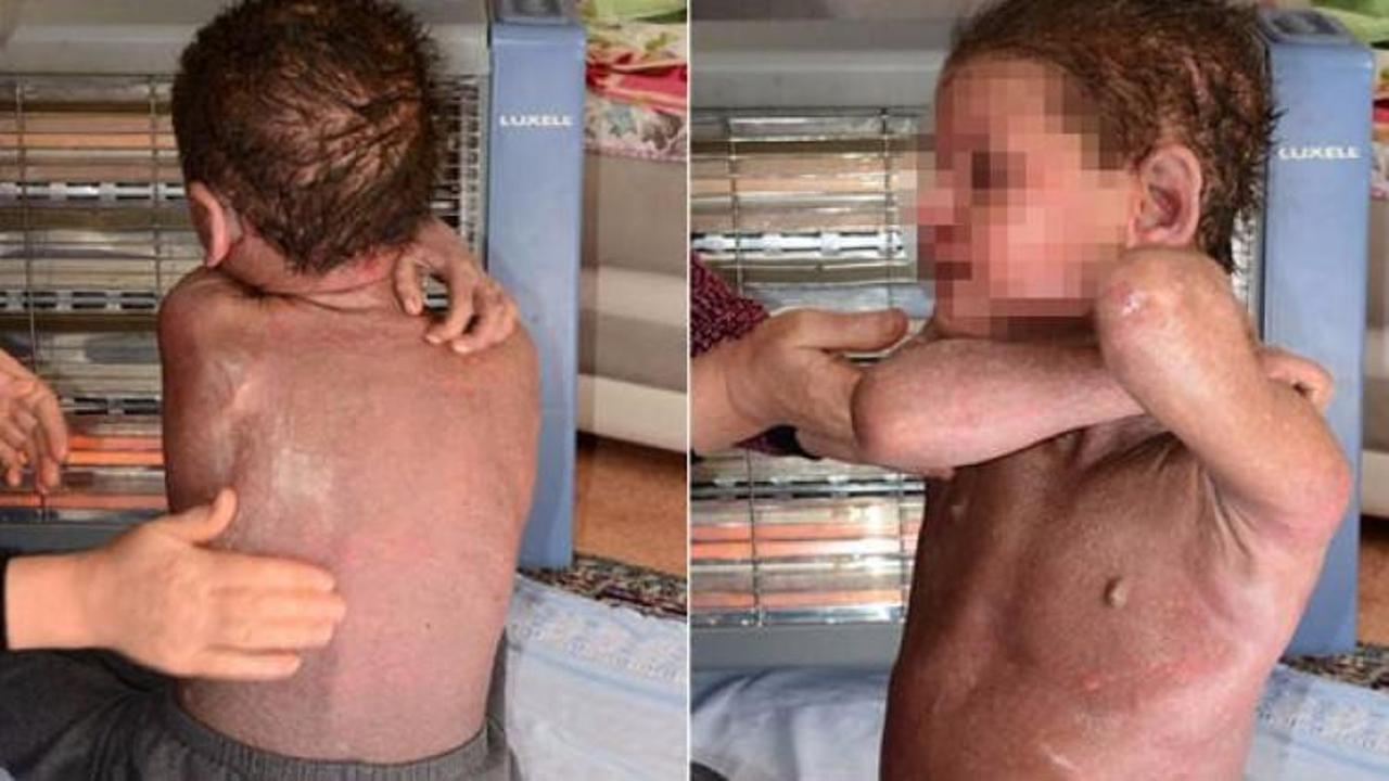 K&uuml;&ccedil;&uuml;k Halil'in b&uuml;y&uuml;k dramı!'Artık &ouml;lmek istiyorum'