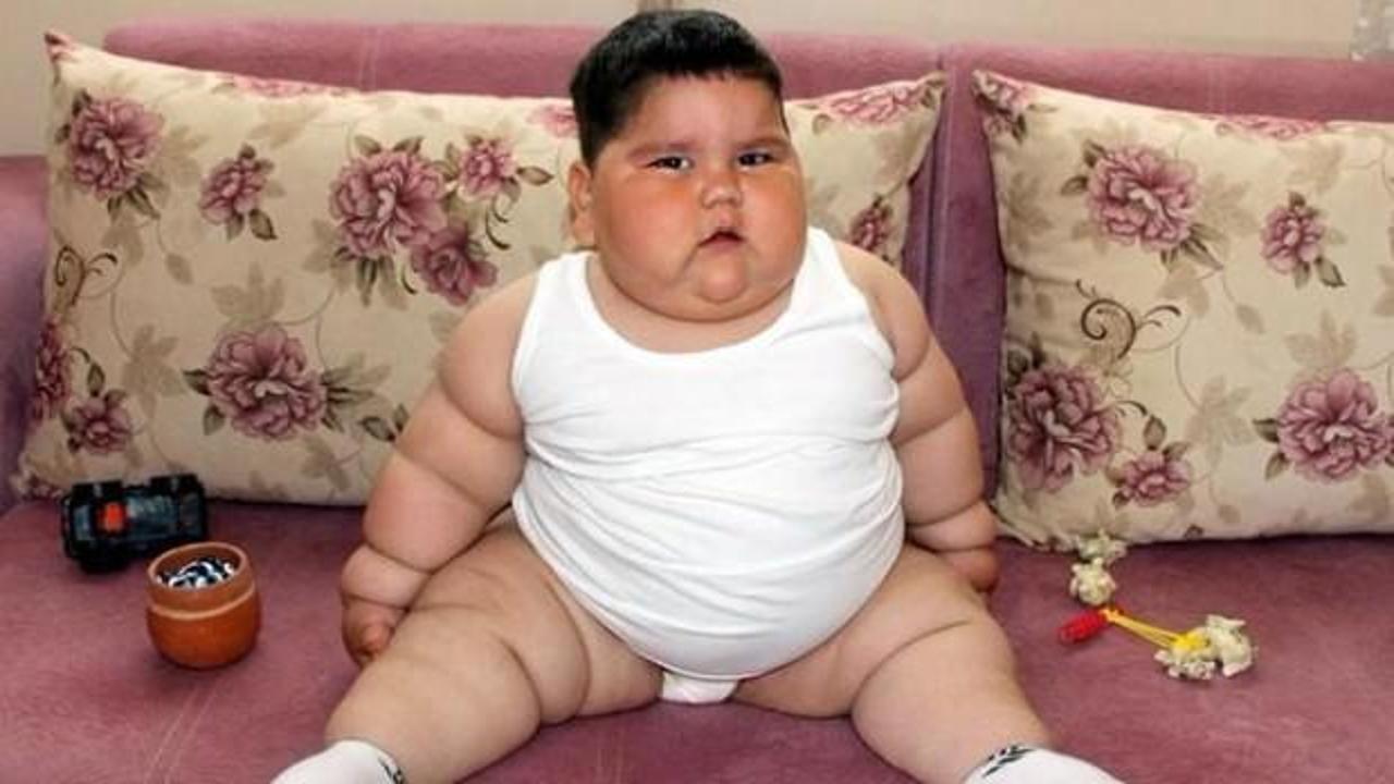 2,5 yaşında 37 kiloydu! Yağız bebekten haber var
