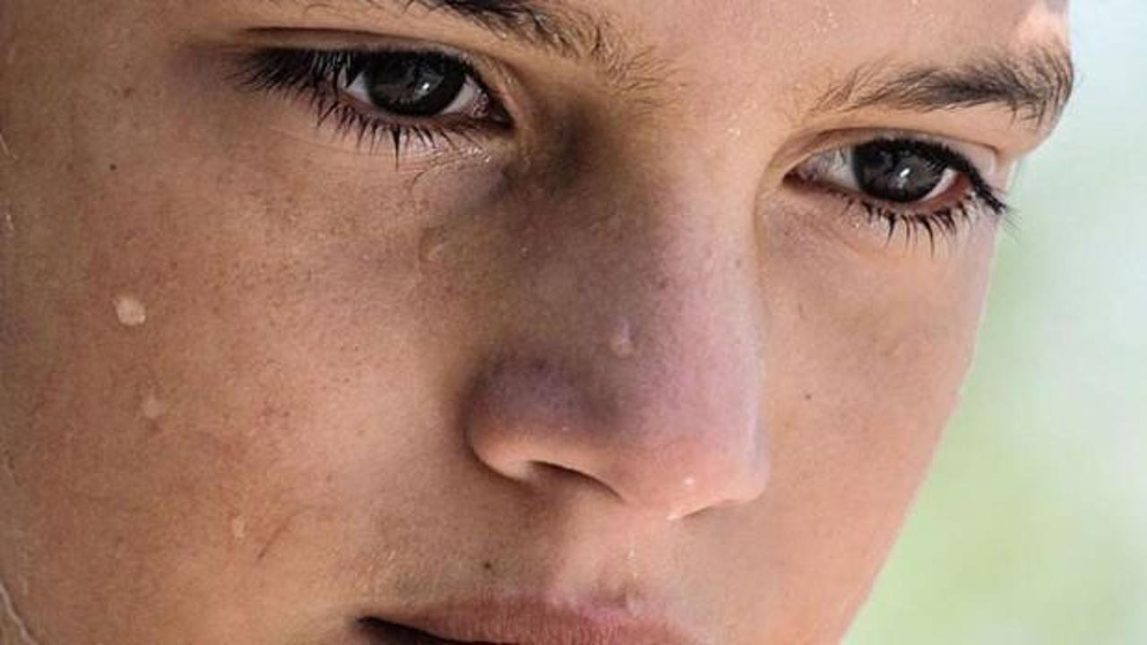 Yüz terlemesi nedir? Sebepleri nelerdir?