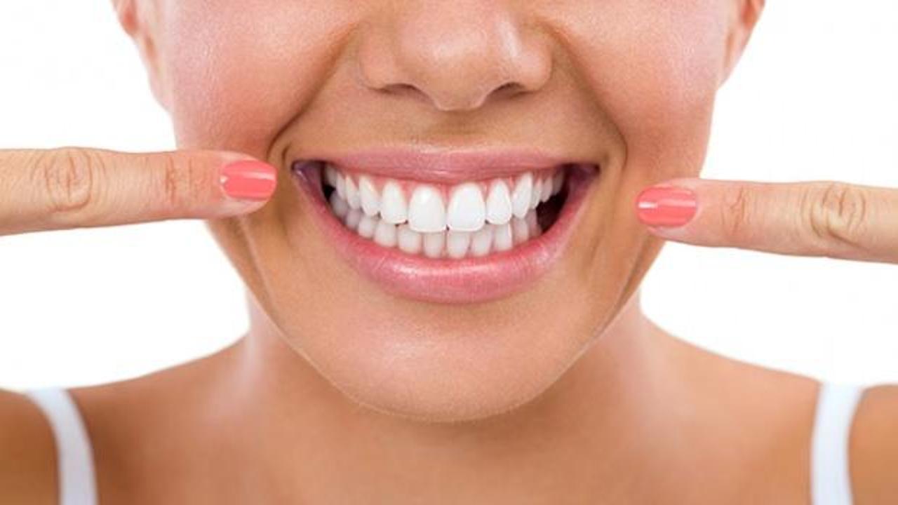 Evde diş beyazlatma yöntemleri! Sadece üç dakikada bembeyaz dişler
