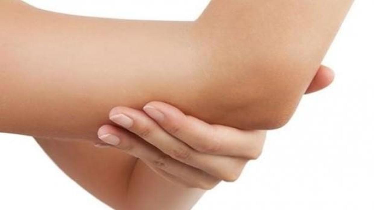 Dirsek kararmasına evde doğal &ccedil;&ouml;z&uuml;mler! Dirsekler nasıl beyazlar?