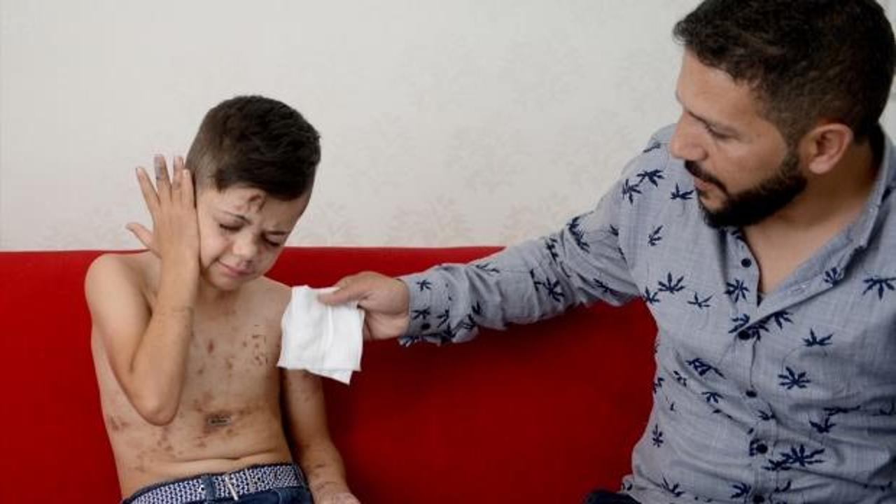 Suriyeli Abdülmuin'e Türkiye'den şefkat eli
