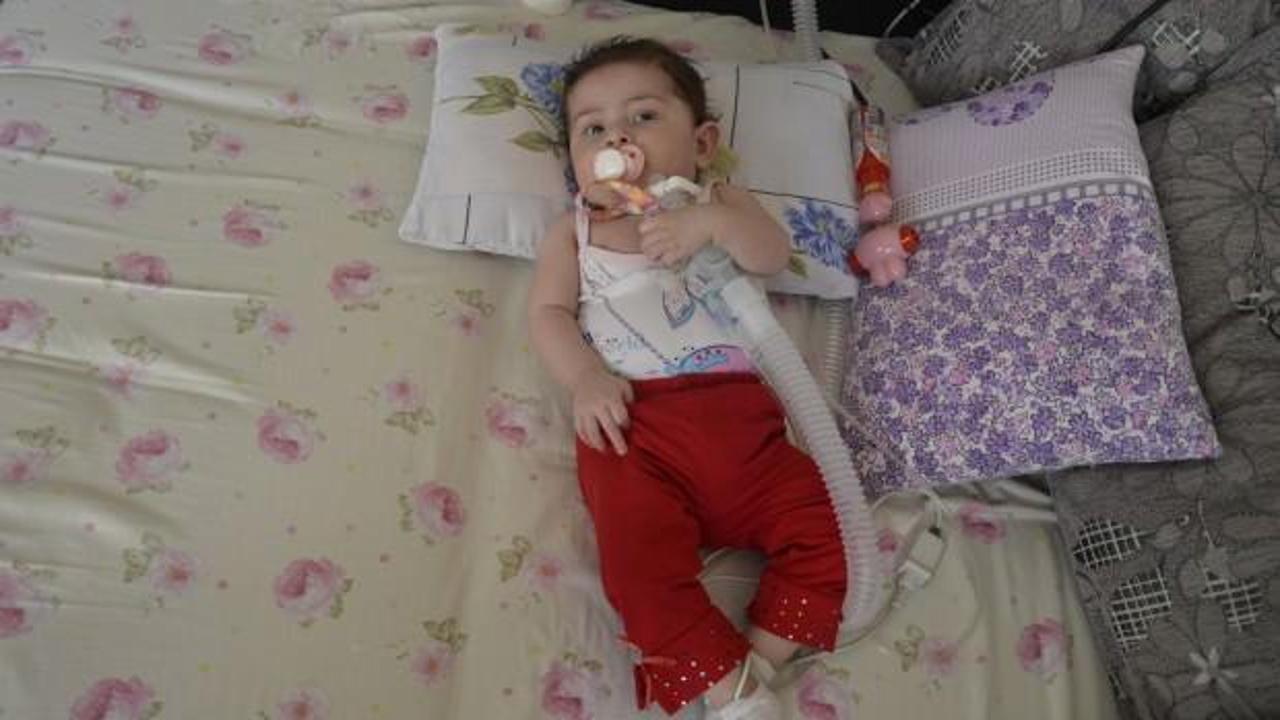 11 aylık minik Elif'in yaşamı yürekleri sızlatıyor