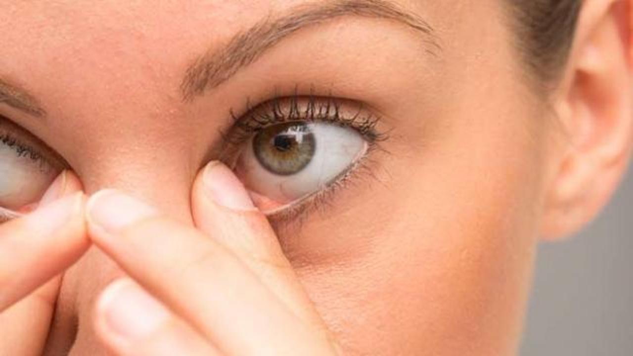 Kaş ve kirpiklerde görülen akarlar tehlikeli midir?