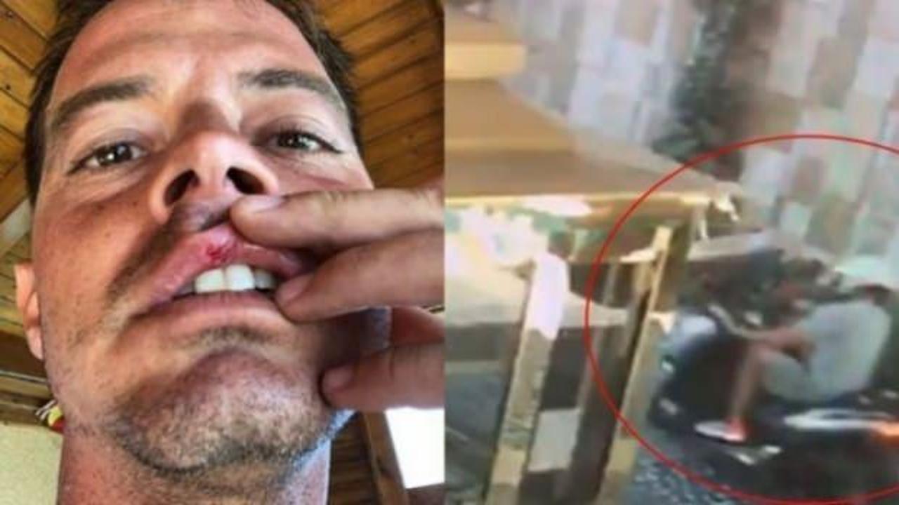 Alp Kırşan kaza geçirdi!