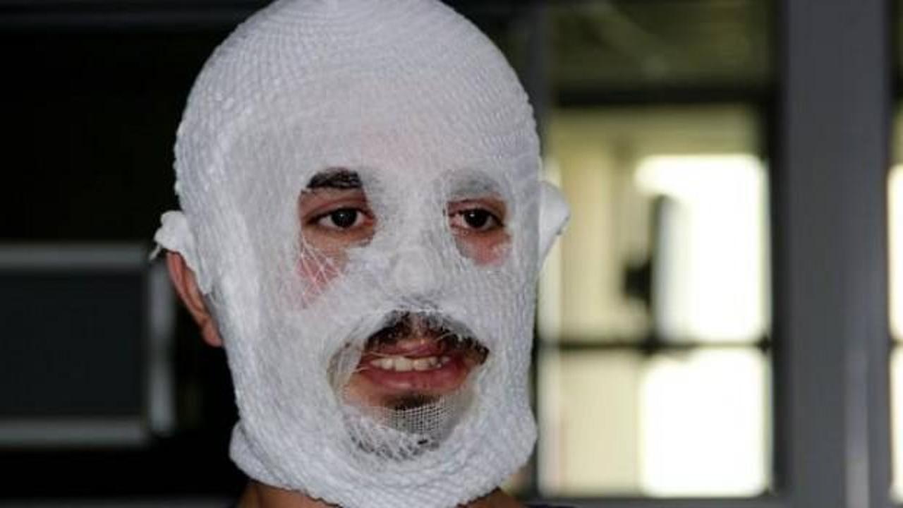 Krem bu hale getirdi!