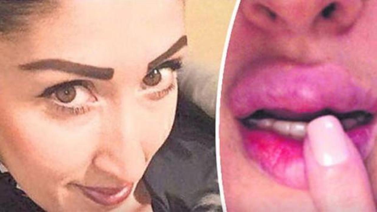 İzmir'de estetik faciası!