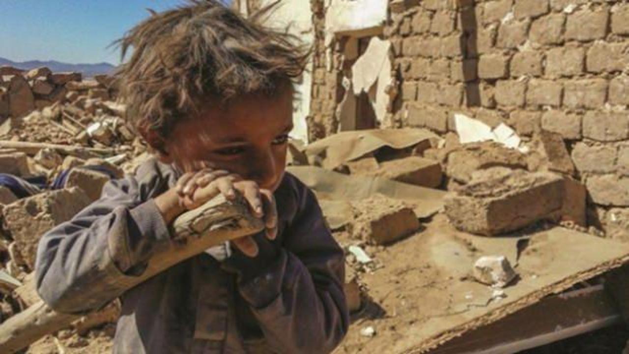 Yemen, dünyanın en büyük insani krizini yaşıyor!
