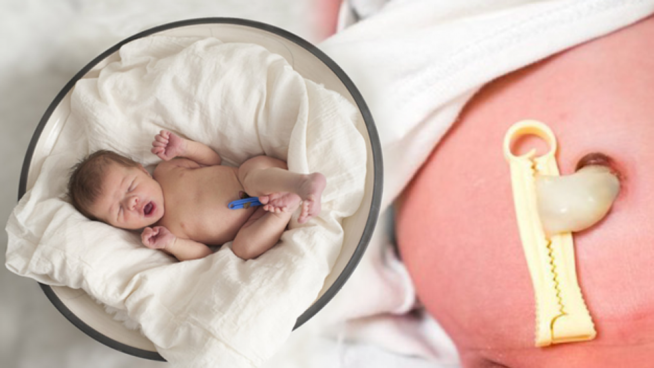 Plasenta Previa nedir? Bebeklerde göbek bağı bakımı nasıl yapılır? Göbek kordonu uzunsa...