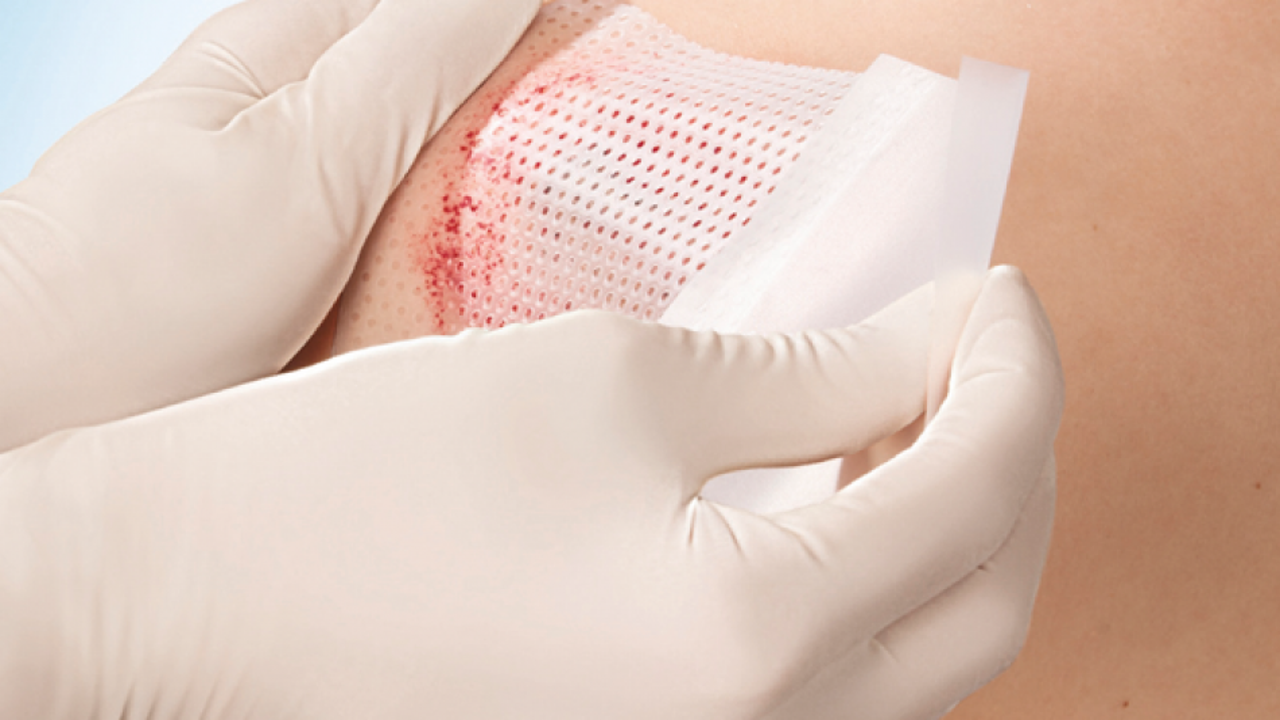 Hangi yaraya nasıl m&uuml;dahale edilmeli?