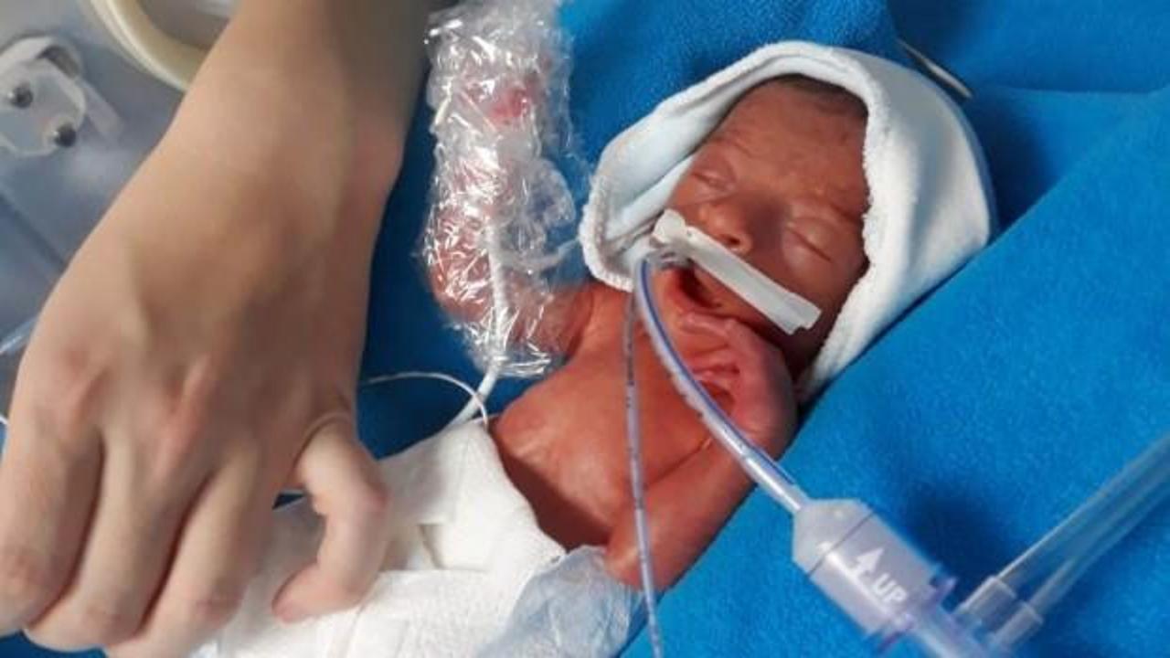 700 gramlık parmak bebek hayata tutundu