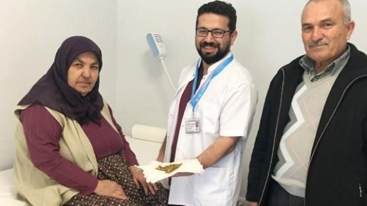 Safra kesesinden &ccedil;ıktı! Tam 311 tane...