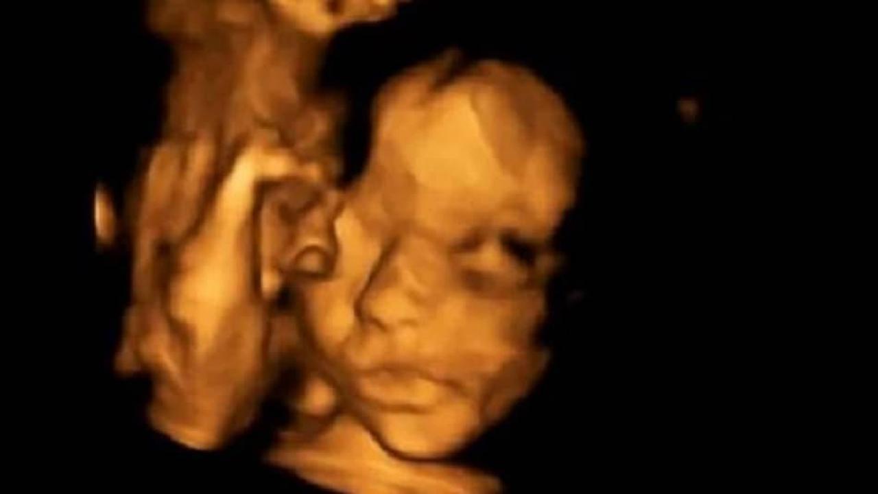 İngiltere'de tarihe ge&ccedil;ecek olay! Anne karnından alınan bebek...