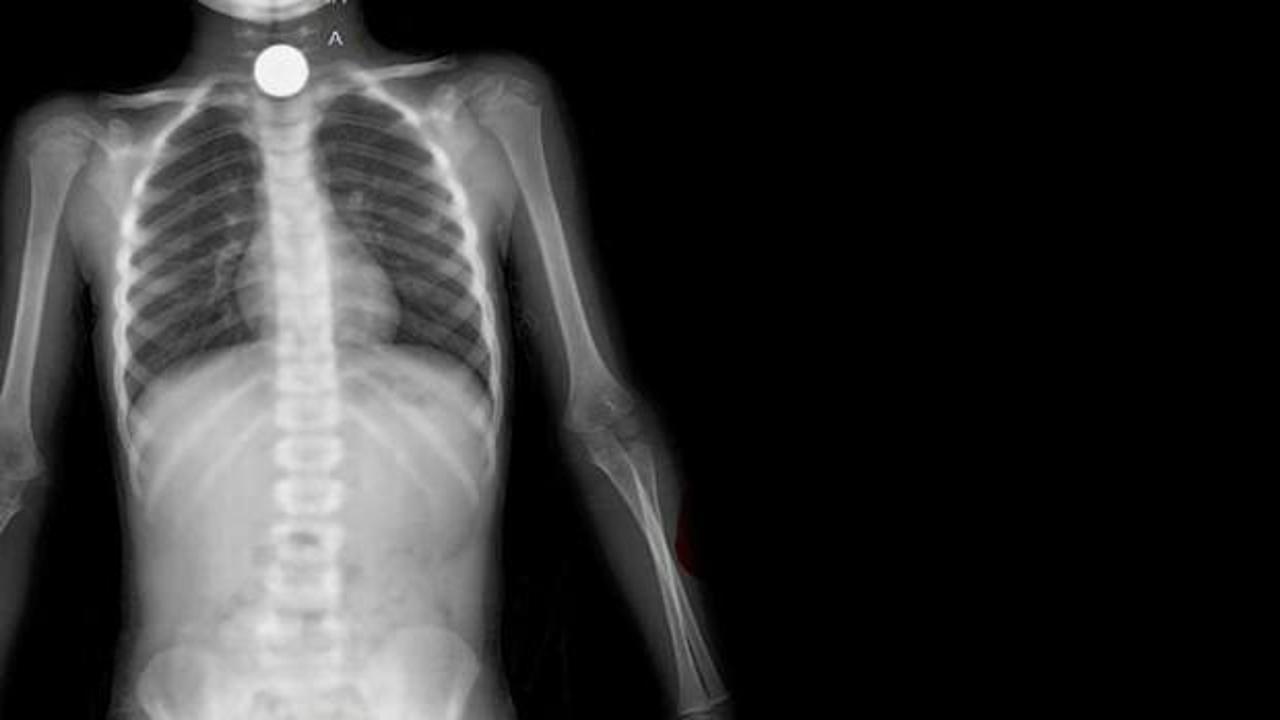 Korkun&ccedil; olay! &Ccedil;izgi film izlerken...