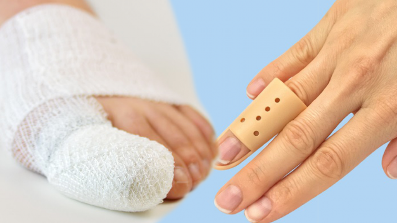 Parmak kırılması neden olur? Parmak kırılması belirtileri neledir?