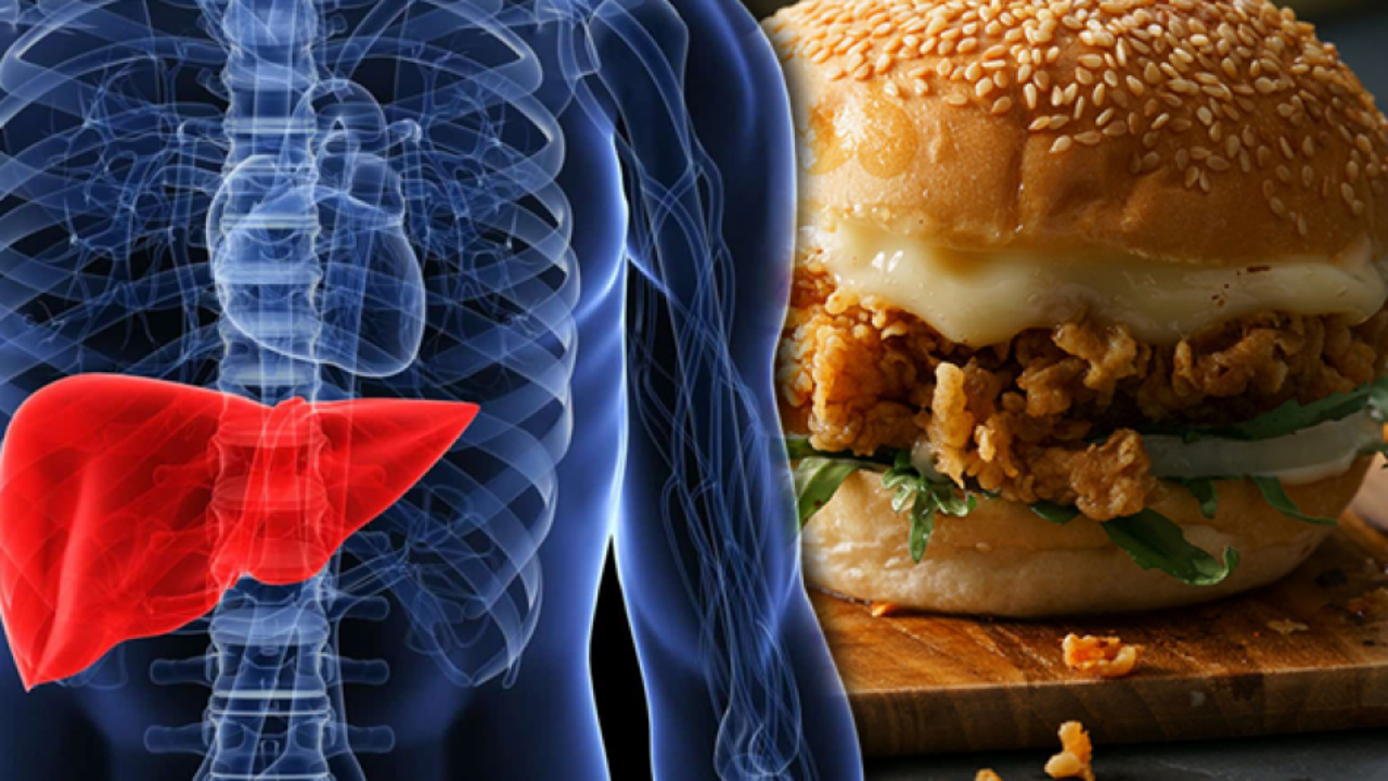 Trans yağ hangi besinlerde bulunuyor? Trans yağın neden olduğu hastalıklar...