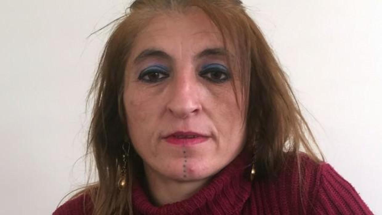 Kafasında bı&ccedil;akla hastaneye kaldırılmıştı! Eşinden şok su&ccedil;lama