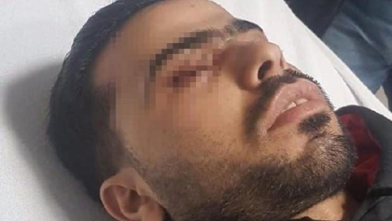Suriyeli işçinin gözüne zımba çivisi saplandı