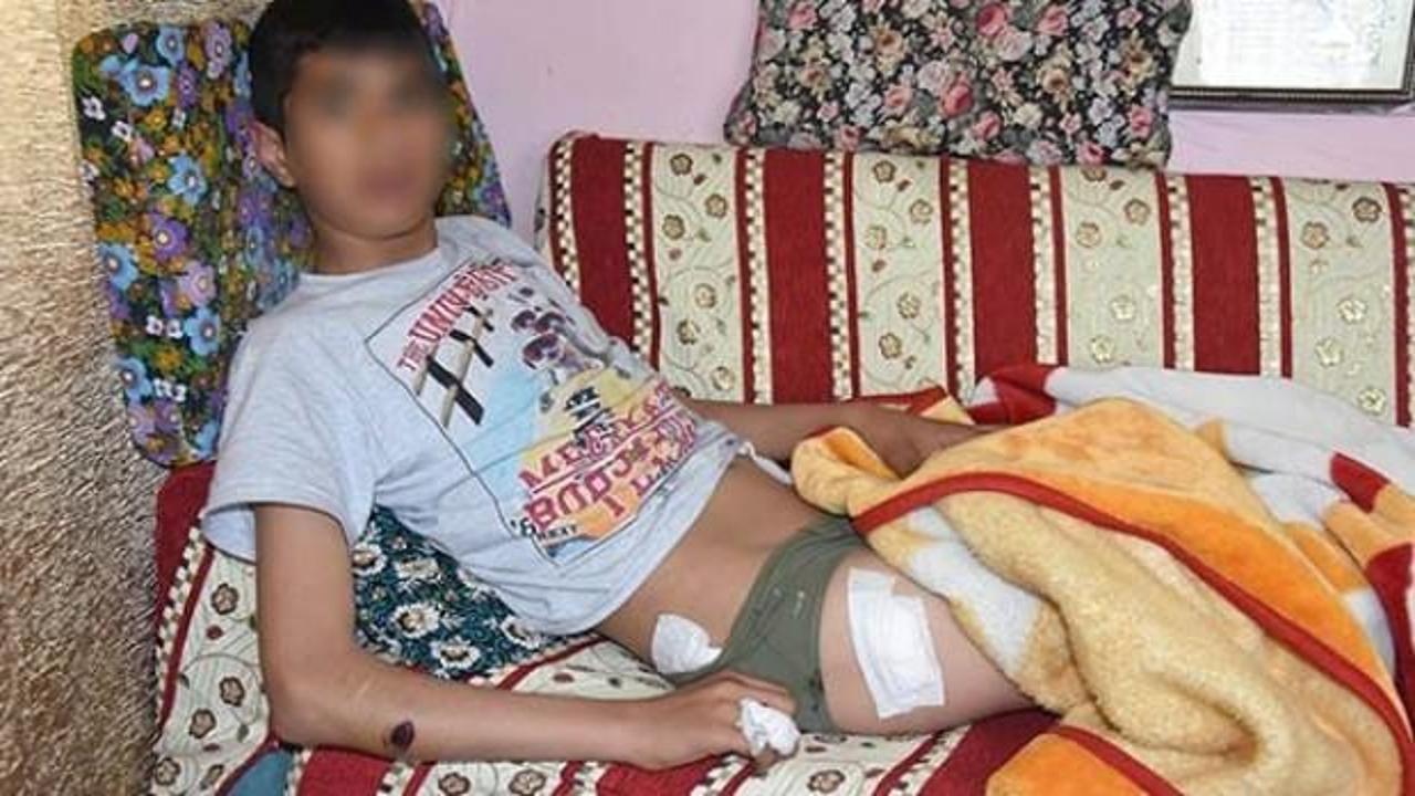 Sokakta oynayan &ccedil;ocukları av t&uuml;feğiyle yaraladı!