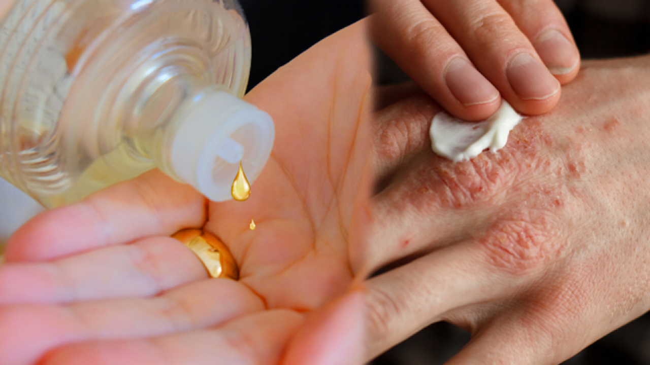 Kolonya zararlı mıdır? Cilt hastalığı olanlar dikkat!