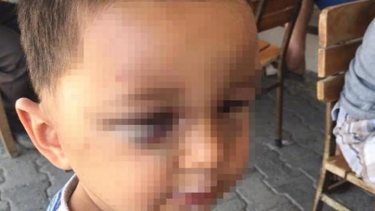 3 yaşındaki çocuğa kan donduran şiddet