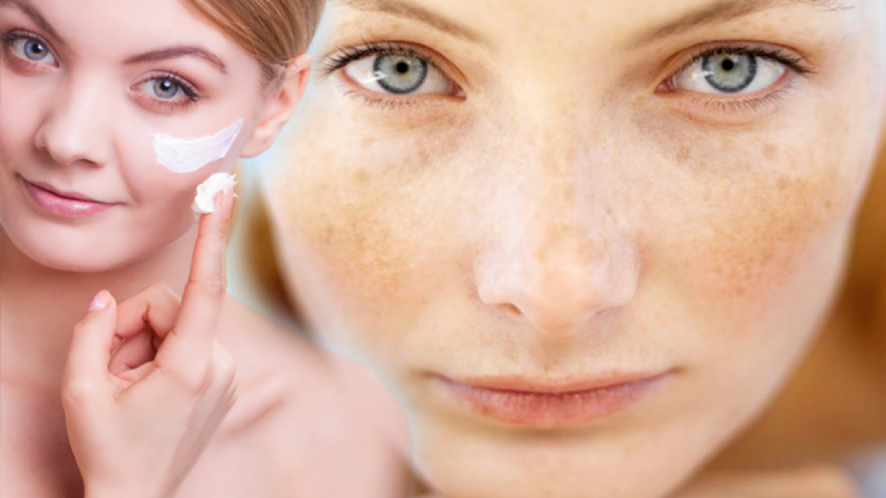 G&uuml;neş lekesi nasıl ge&ccedil;er? Tatil sonrası oluşan g&uuml;neş lekeleri i&ccedil;in maske