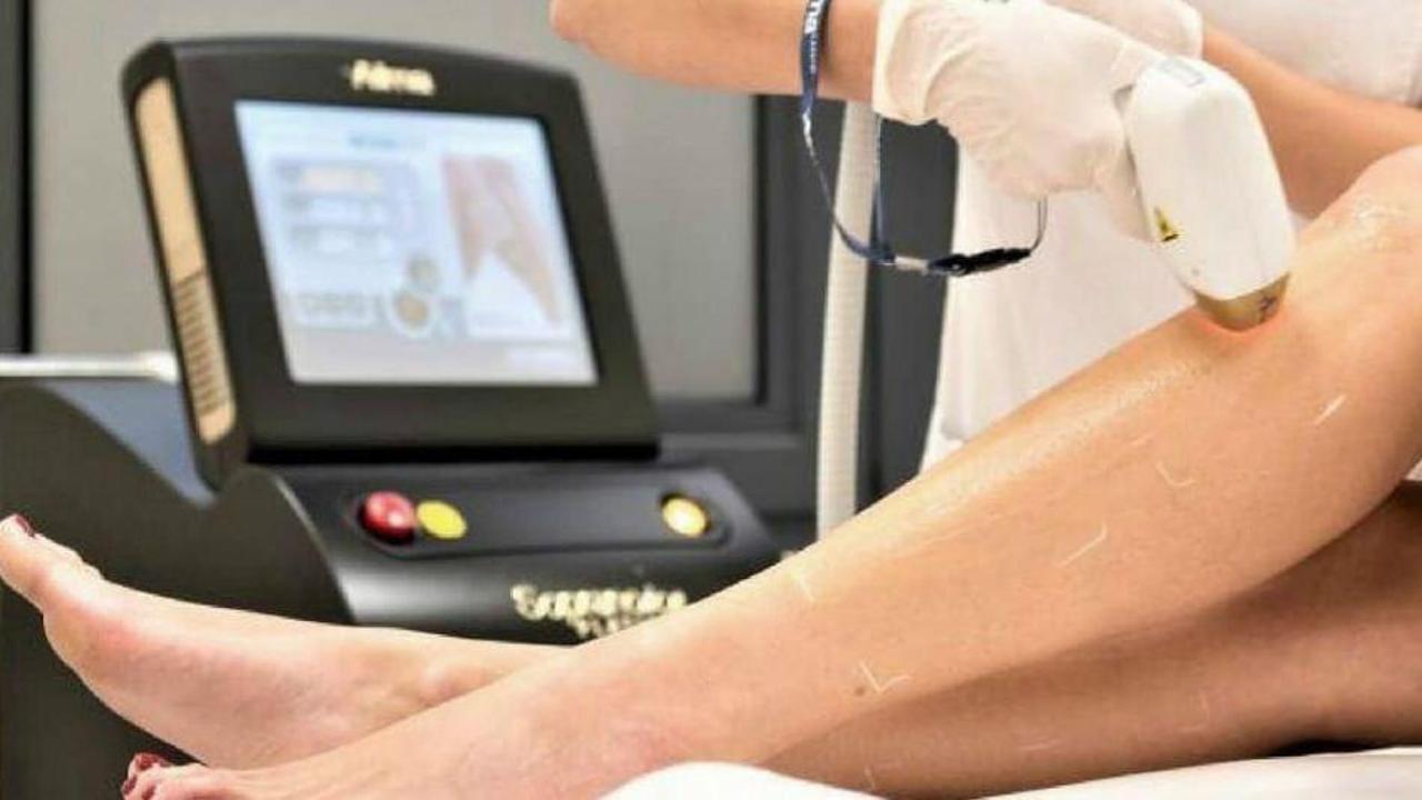 Buz Lazer epilasyon nedir? Buz lazer epilasyon işe yarıyor mu?