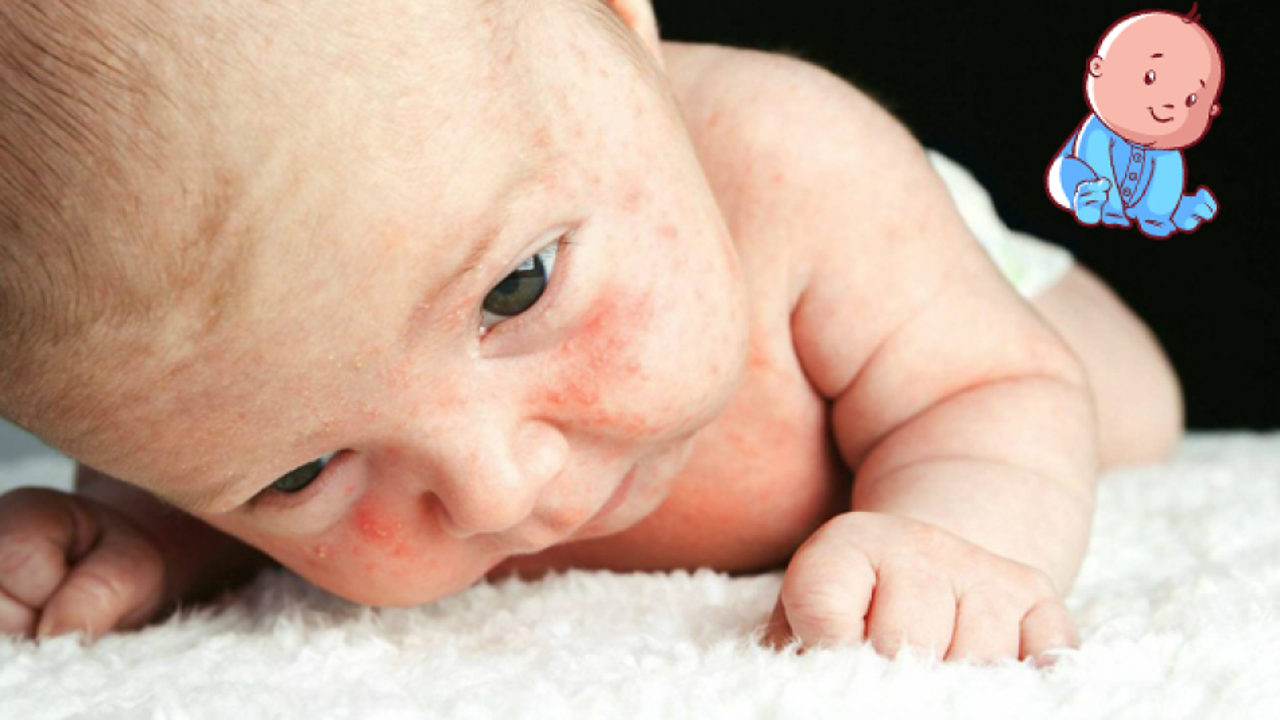 Bebeklerde isilik nasıl geçer? İsilik olan bebeklerde doğal çözümler ve isilik nedenleri
