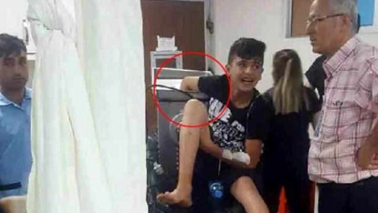 Gaziantep'te 14 yaşındaki çocuk elini kıyma makinesine kaptırdı