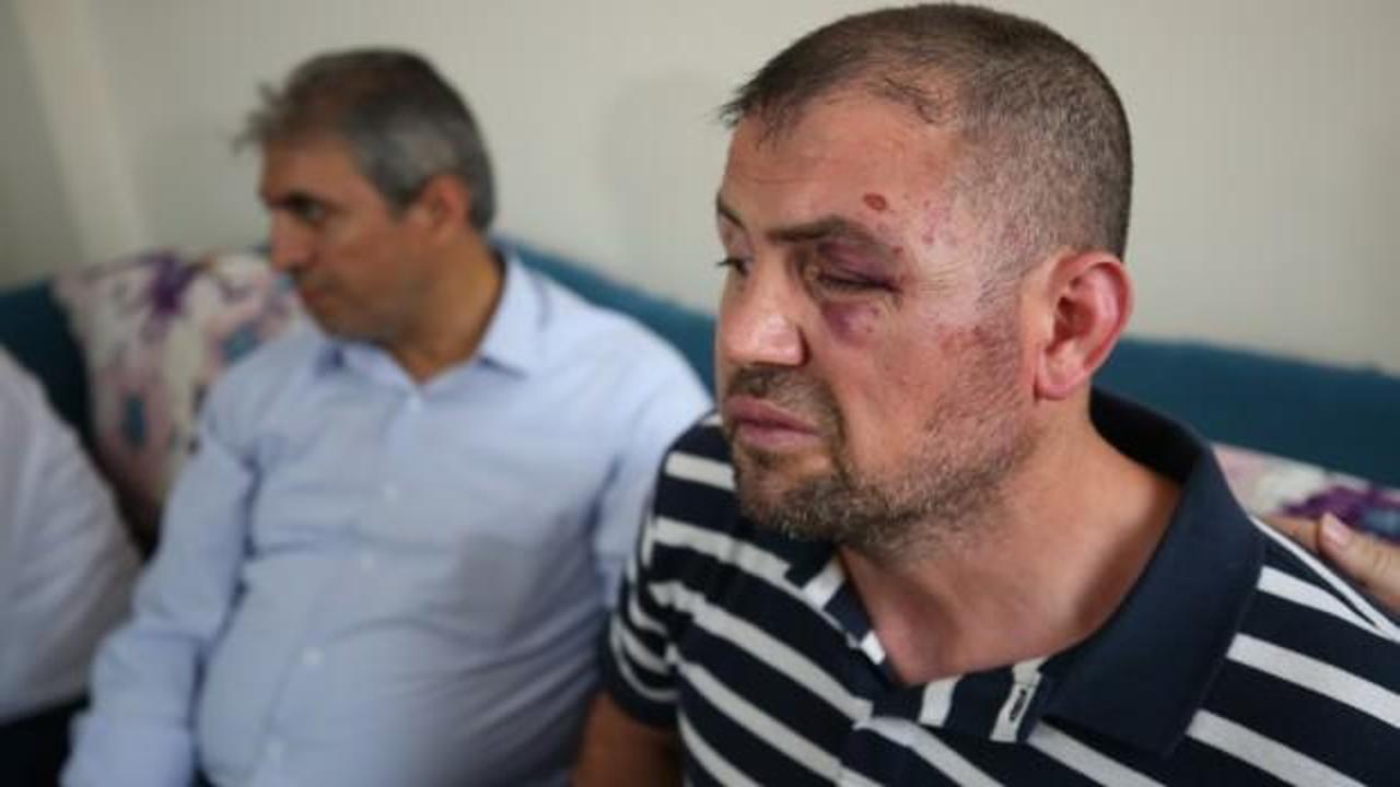 Gaziyi öldüresiye döven saldırganlar tutuklandı
