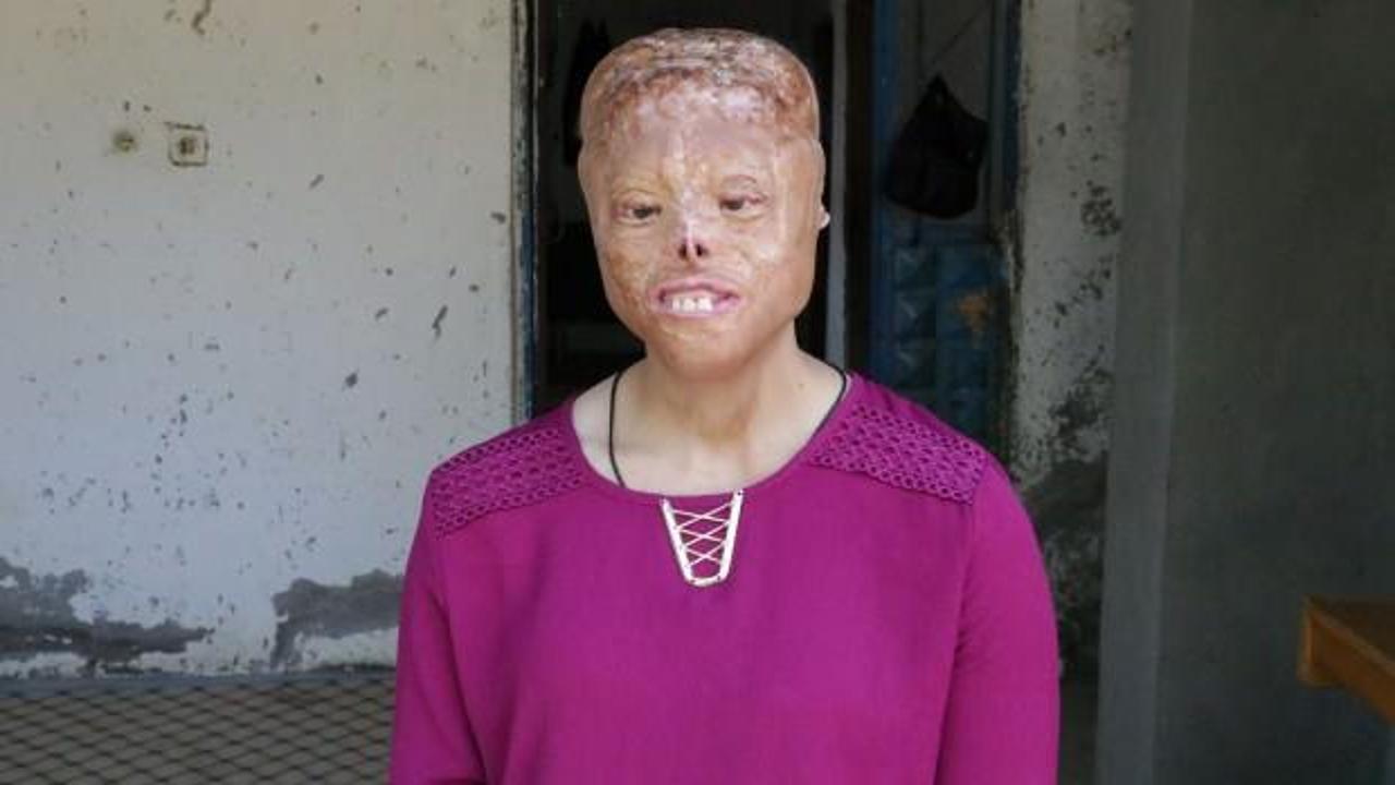 20 yaşındaki Leyla yeni y&uuml;z bekliyor!
