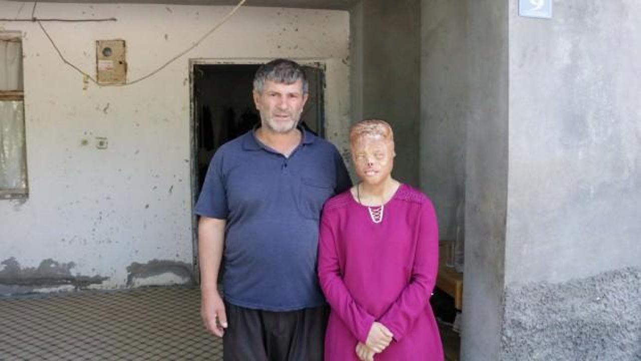 Leyla y&uuml;z nakli bekliyordu! Bakanlık harekete ge&ccedil;ti