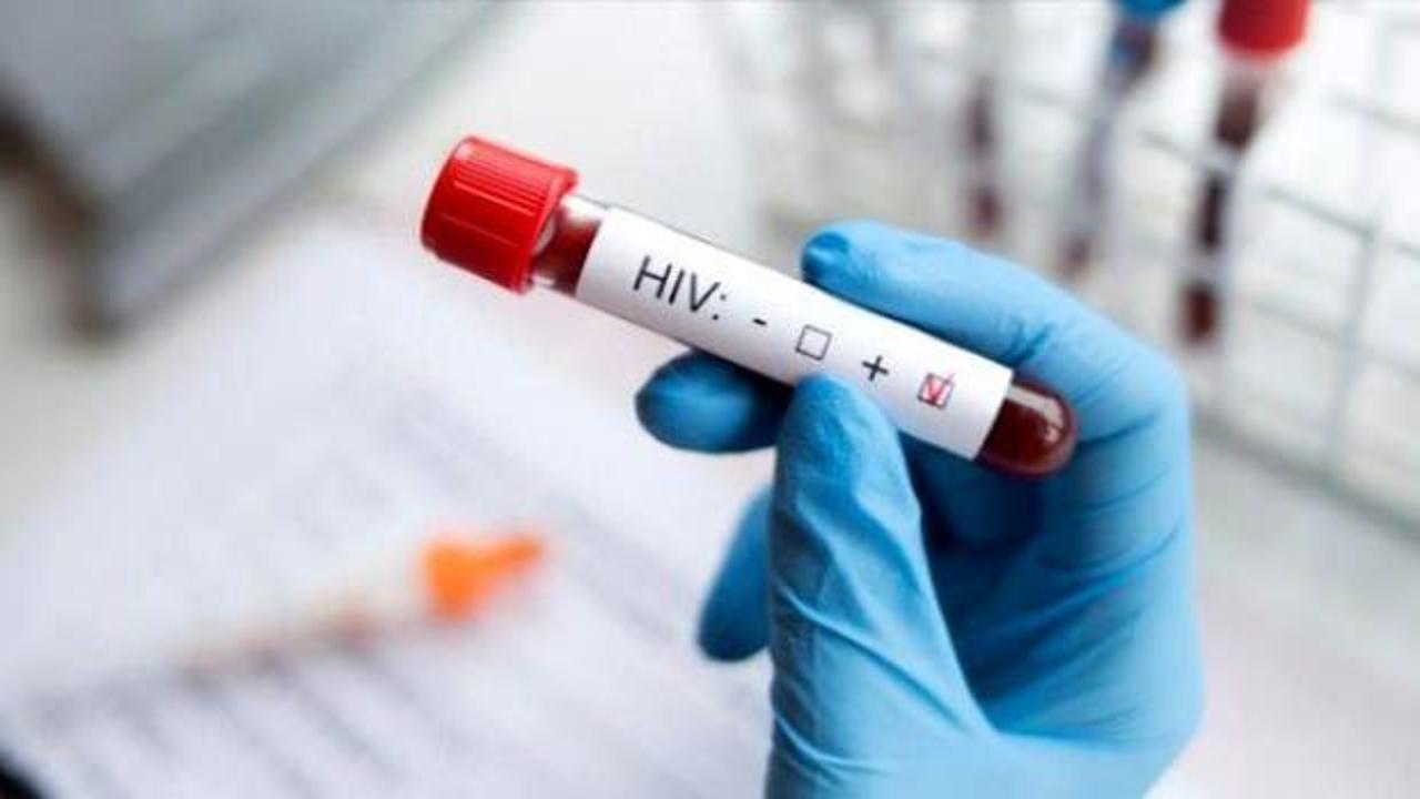 İran'da sağlık skandalı: 300 kişiye HIV bulaştırdı!