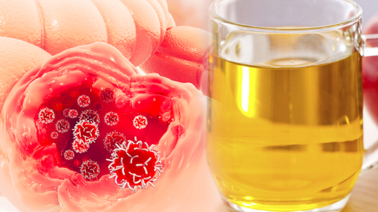 Kolon (kalın bağırsak) kanserinin belirtileri nelerdir? Kolon temizliği nasıl yapılır?