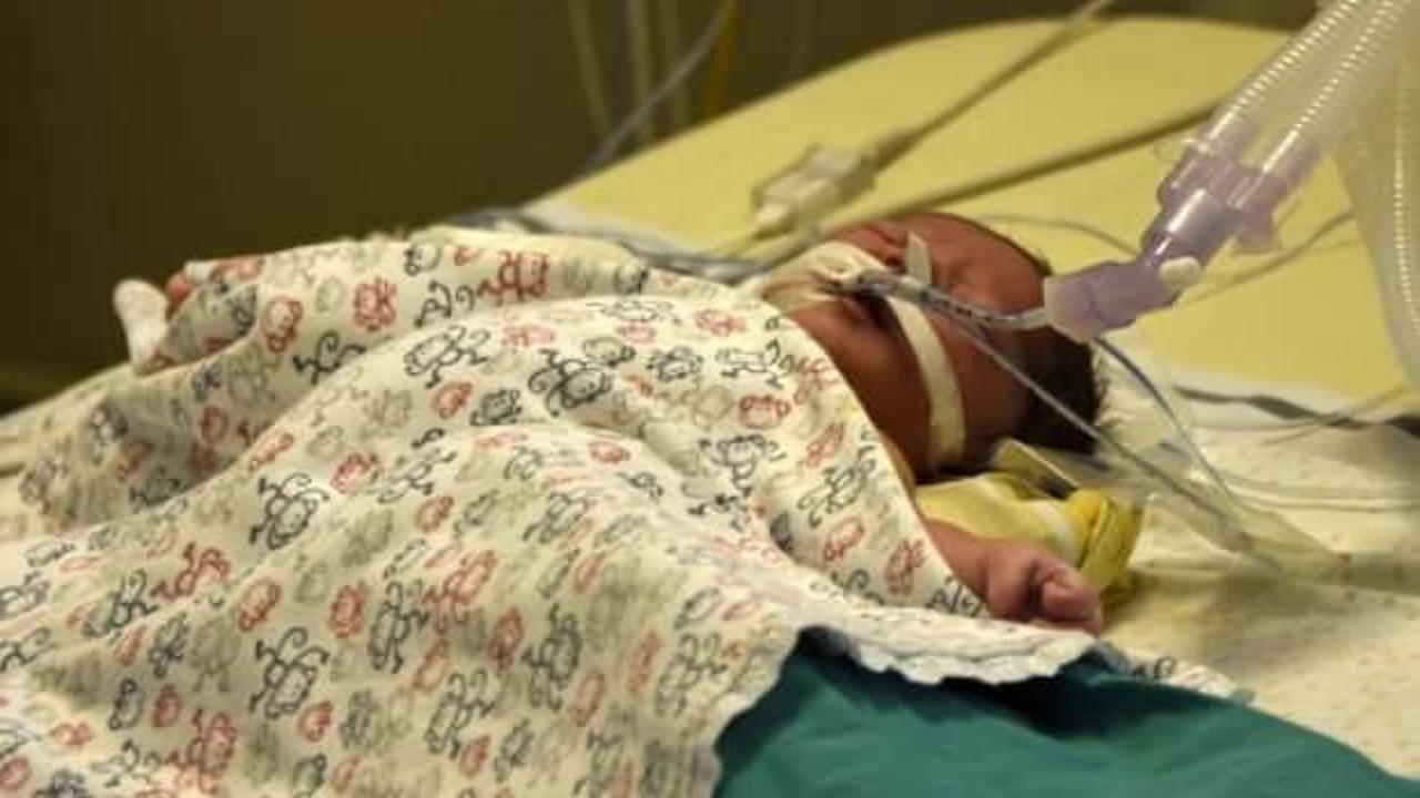 Muhammet bebek kalbi durdurularak ameliyat edildi