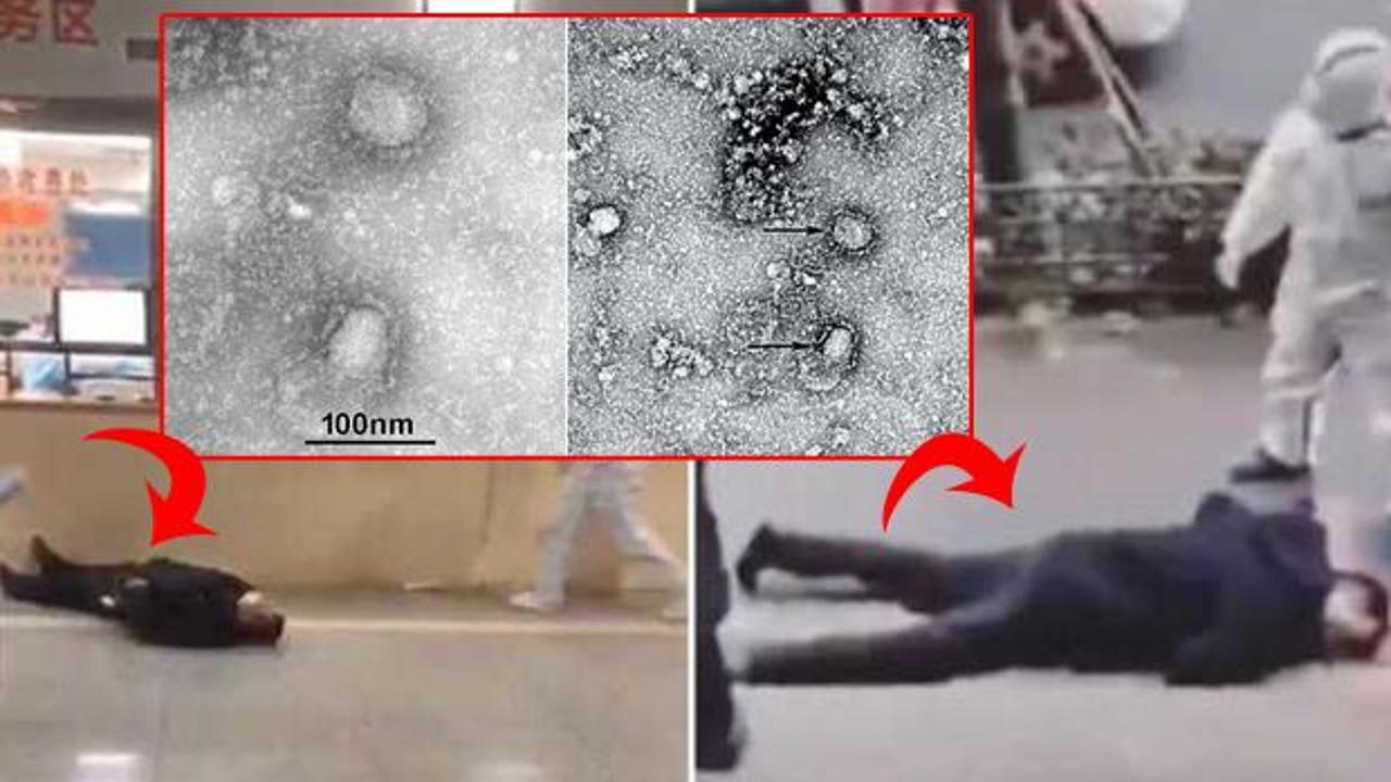 Cesetler sokaklarda! Coronavirüsün mikroskobik ilk görüntüleri yayınlandı