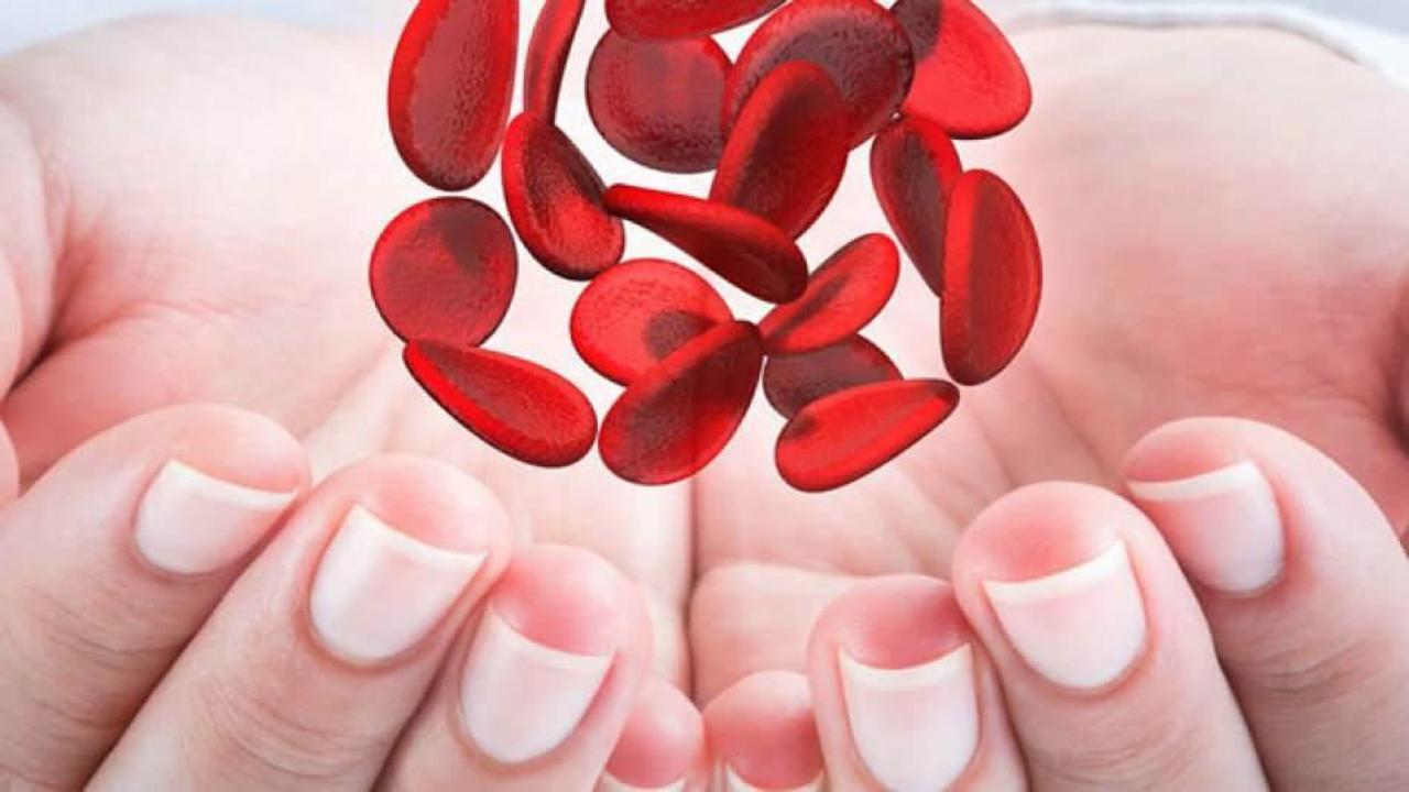 Akdeniz anemisi (Talasemi) nedir? Akdeniz anemisi belirtileri nelerdir? Akdeniz anemisi tedavi